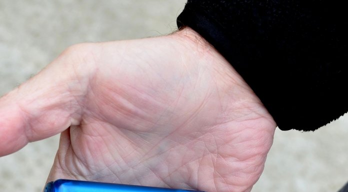 cukrzyca, sztuczna trzusta, liam Zebedee,